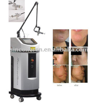 CO2 Laser Machine for Acne Removal, Wrinkles Removal